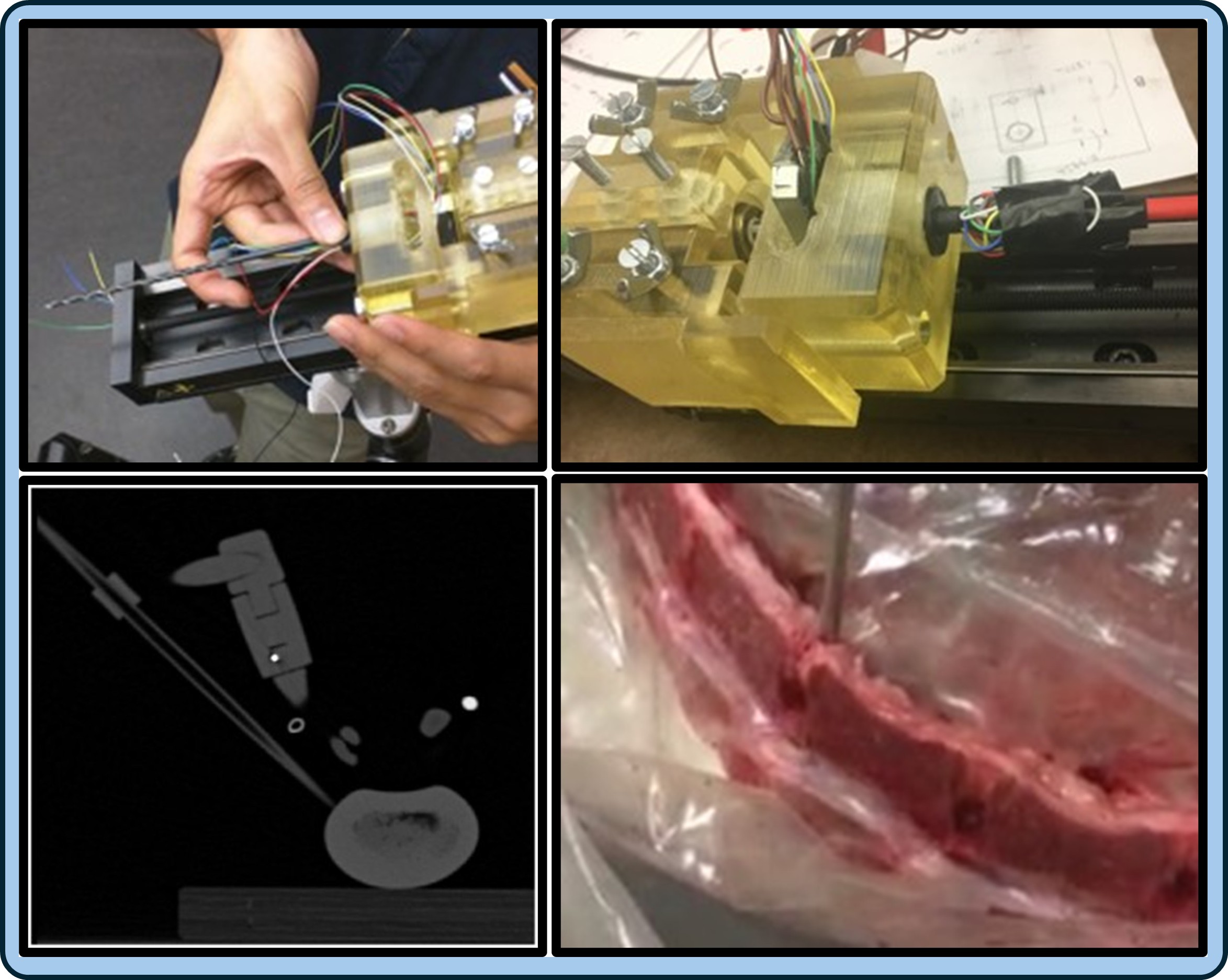 Spinal Cavity Creator