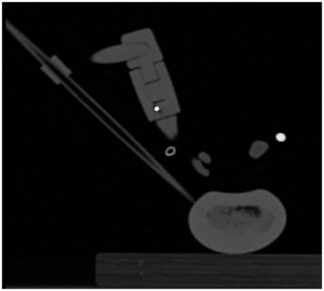 Spinal Cavity Creator